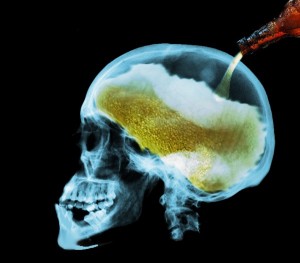 brain alcoholic
