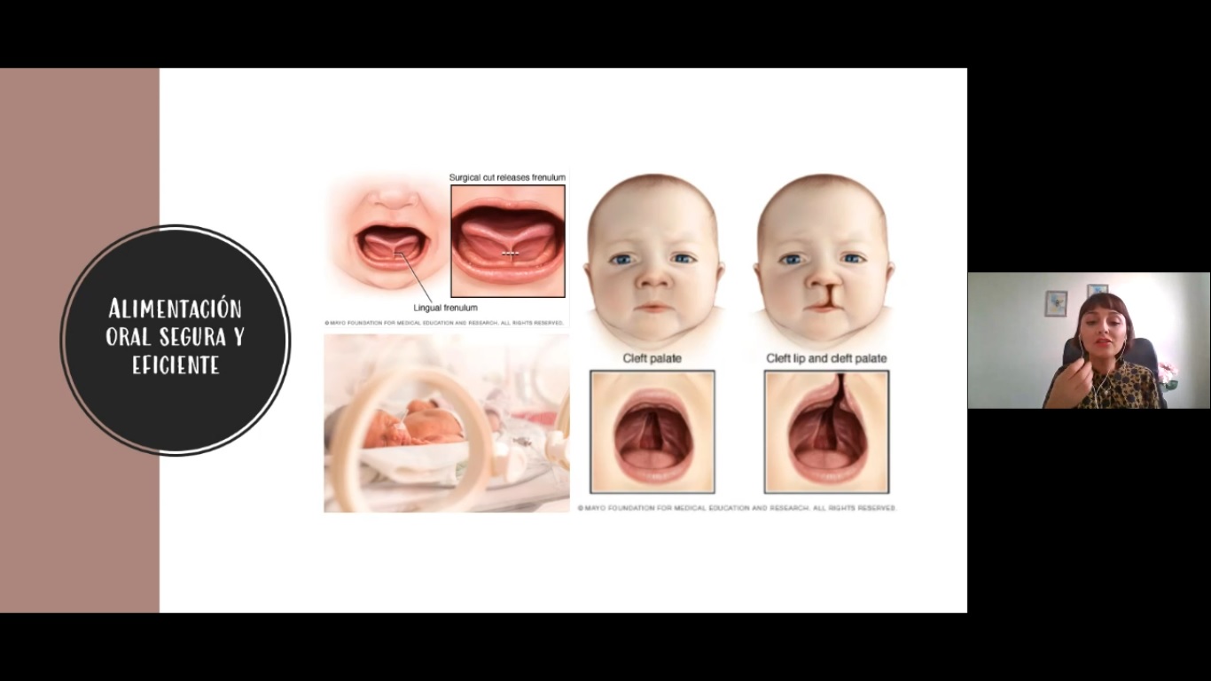 Charla Rol fonoaudiologo lactancia materna 2
