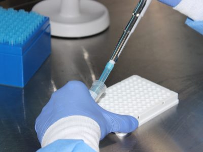 La investigación universitaria tiene impacto directo en la sociedad
